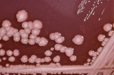 Colonies of <em>Proteus mirabilis</em>