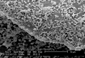 P. mirabilis Biofilm on Polycarbonate CDC Coupons