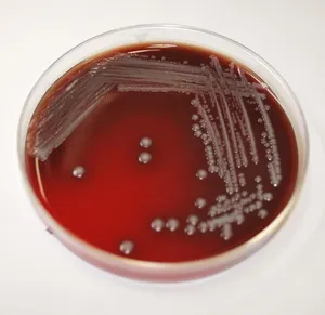 Sheep Blood Agar Growth of Yersinia pestis After Incubation