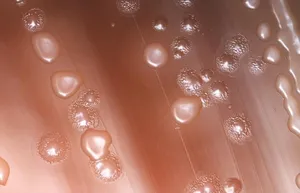 Colonial Characteristics of Streptococcus pneumoniae on Agar