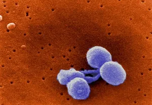 Streptococcus pneumoniae