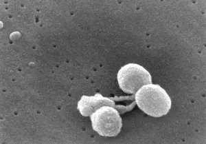 Streptococcus pneumoniae