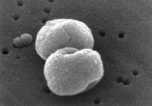 Streptococcus pneumoniae