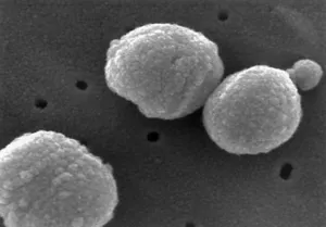 Streptococcus pneumoniae