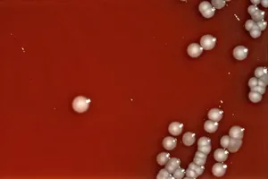 Blood Agar Growth Pattern of Providencia alcalifaciens Bacteria
