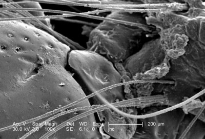 Image of <em>Borrelia burgdorferi</em>