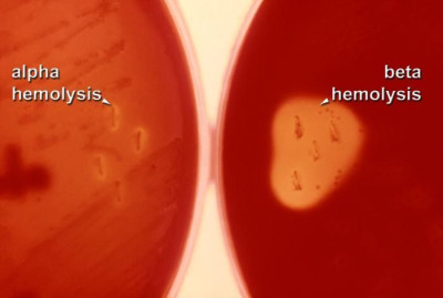 Image of Streptococcus mitis