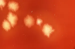 Clostridium septicum Colonies on Petri Dish at 2X