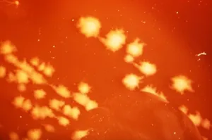 Clostridium septicum Rods on Petri Dish Culture