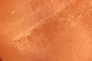 High-Magnification View of Clostridium Septicum Culture