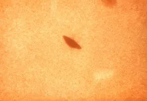 Non-Hemolytic Streptococcus salivarius Subsurface Colony on Blood Agar