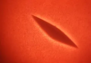 Subsurface Narrow-Zone Hemolysis by Non-Hemolytic Streptococcus pyogenes Colony