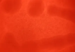 Non-Hemolytic Group A Streptococcus on Blood Agar