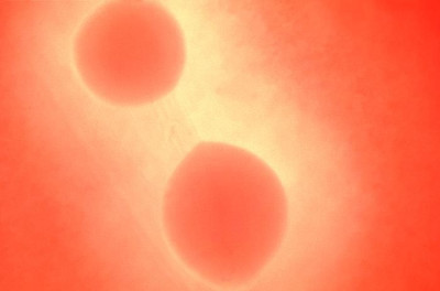 Image of <em>Streptococcus pyogenes</em>