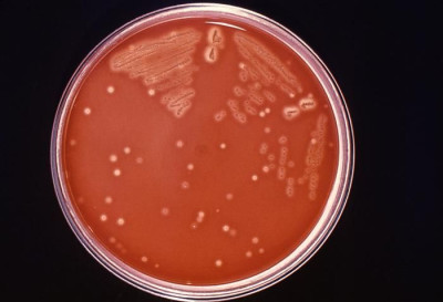 Image of Streptococcus pyogenes