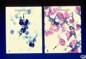 Etiologic Agents of Ehrlichioses