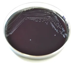 Colonial Growth of Francisella tularensis on BCYE Agar