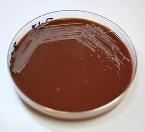 Growth of Francisella tularensis on Chocolate Agar