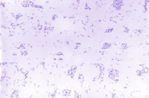 Francisella tularensis Bacteria