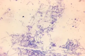 Ultrastructural Hyphae of Aerobic Micromonospora Species