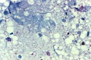 Rickettsia rickettsii Bacteria