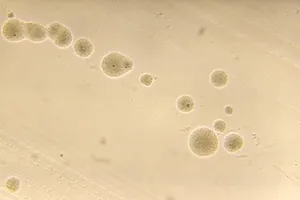 Actinomyces viscosus Microcolonies on BHIA Agar