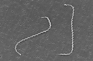 Scanning Electron View of Leptospira interrogans RGA