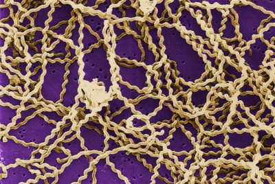 <em>Leptospira sp. </em>