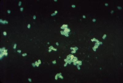 Image of <em>Escherichia coli</em>