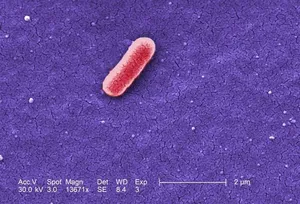 Escherichia coli 