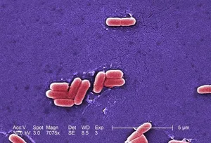 A Number of Gram-Negative Escherichia coli Bacteria