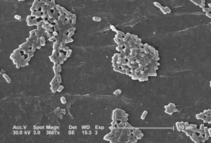Escherichia coli