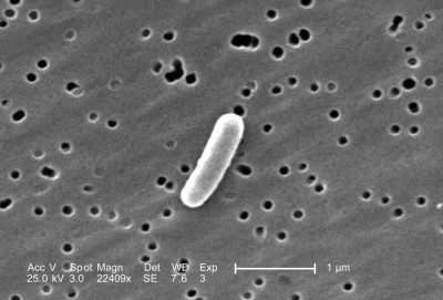 Image of <em>Escherichia coli</em>