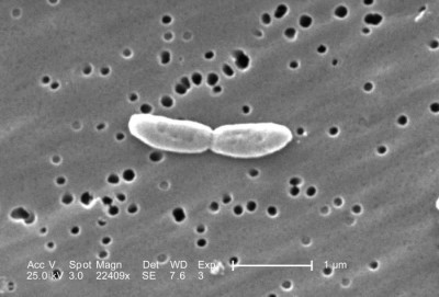 Scanning Electron Micrograph of <em>Escherichia coli</em>