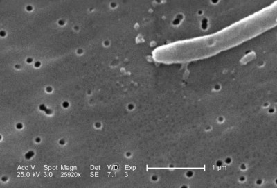 Image of <em>Escherichia coli</em>