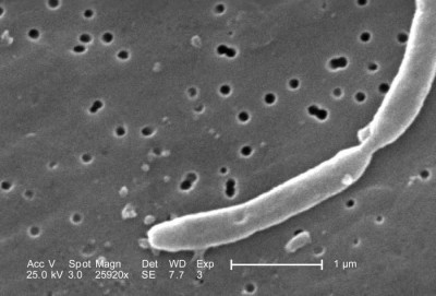 Scanning Electron Micrograph of Escherichia coli