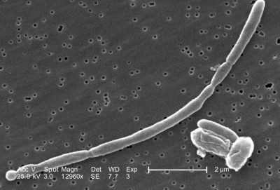 Scanning Electron Micrograph of <em>Escherichia coli</em>