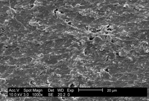 Escherichia coli Biofilm