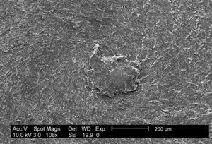 Escherichia coli Biofilm