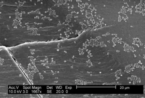 Escherichia coli Biofilm