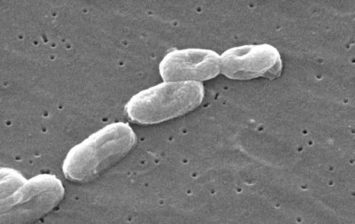 Scanning Electron Micrograph of <em>Burkholderia cepacia</em>