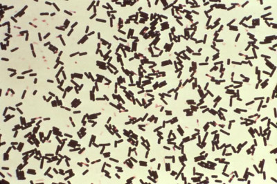 Clostridium perfringens