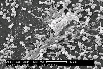 Scanning Electron Micrograph of Staphylococcus