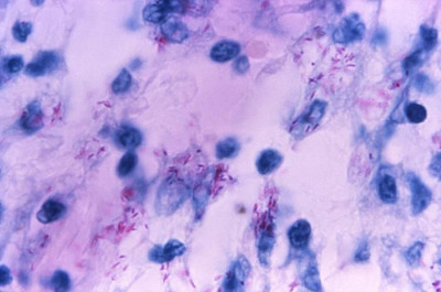 Histopathologic Cytoarchitectural Characteristics