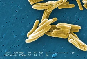 Gram-Positive Mycobacterium tuberculosis