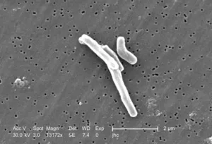 Mycobacterium tuberculosis
