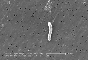 A Single Gram-Positive Mycobacterium tuberculosis Bacterium