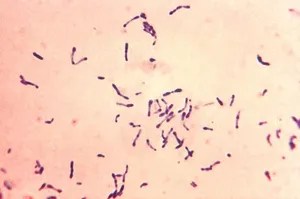 Gram-Positive Corynebacterium diphtheriae Bacteria
