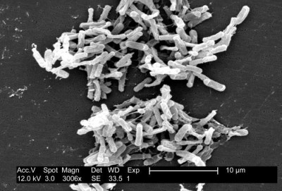 Image of <em>Clostridium difficile</em>