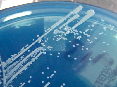 Corynebacterium Striatum on CLED Agar